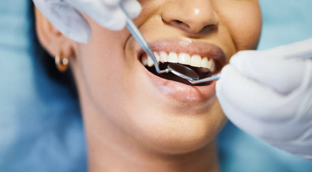 Best Emergency Dentist for Lost Fillings or Crowns in Wauconda, IL
