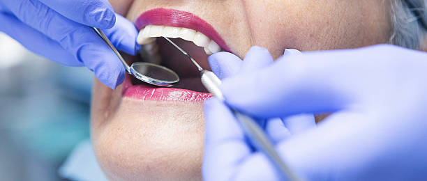 Best Emergency Dental Extractions in Wauconda, IL