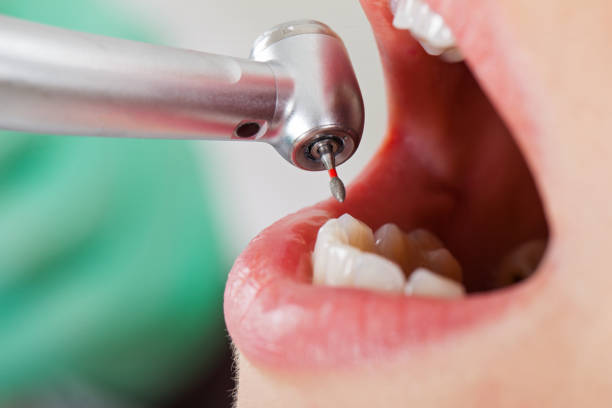 Best Emergency Dentist for Knocked-Out Tooth in Wauconda, IL